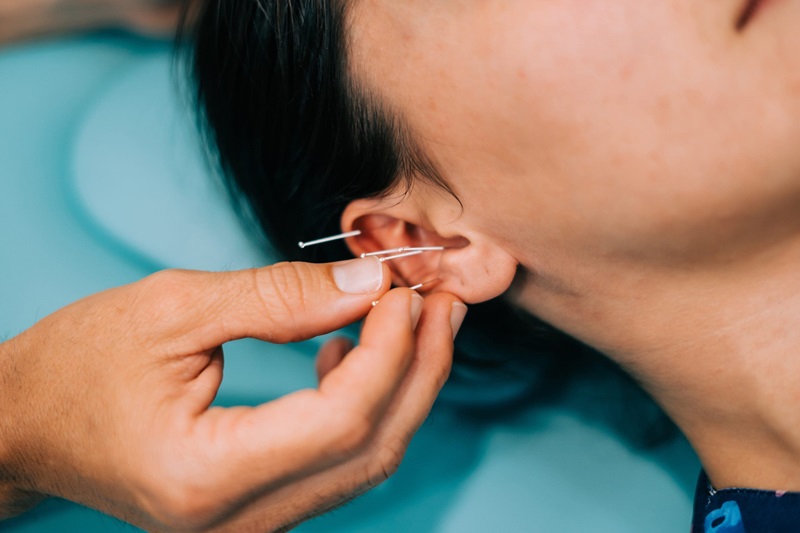 Best Acupuncturist in Lancashire