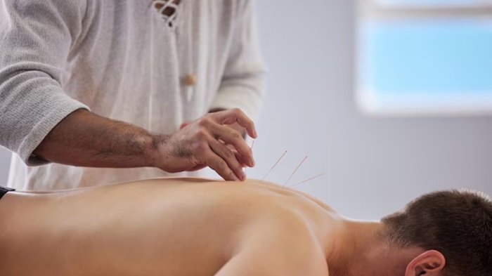 Acupuncturist Lancashire