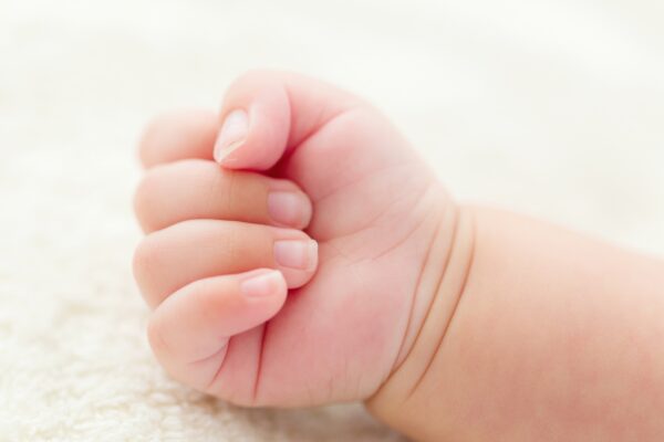 Circumcision procedure Nelson & Pendle – safe clinical setting