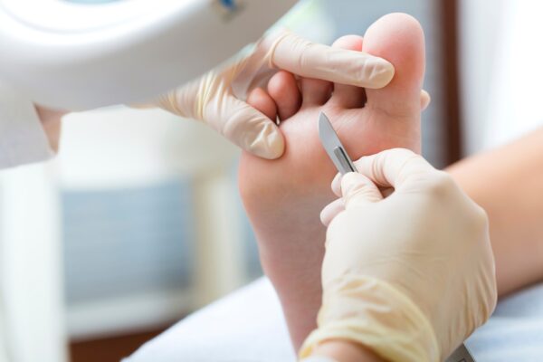 Podiatry Nelson & Pendle foot health assessment at Wellness @ The Clinic
